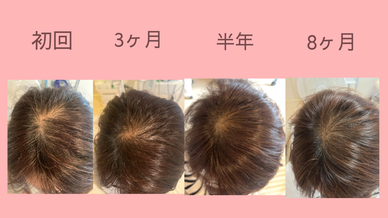 3新